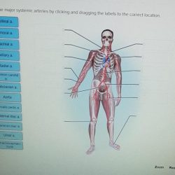 Label the major systemic arteries