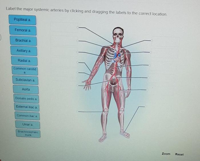 Label the major systemic arteries