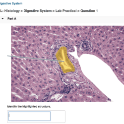 Digestive pal question system models quiz highlighted solved tooth type which answer problem been has structure incisor molar canine premolar